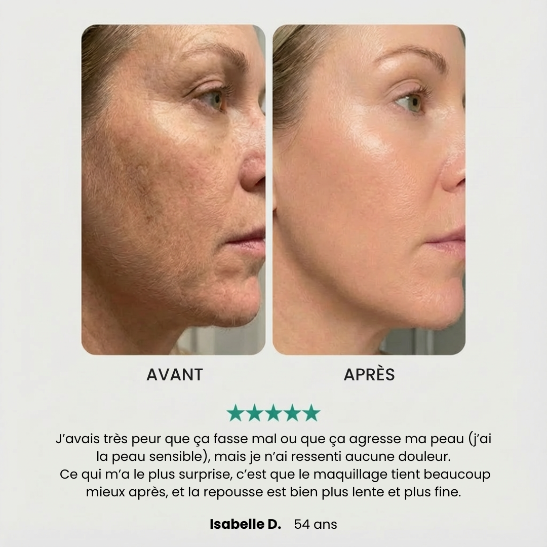 EpilPro - Épilateur visage