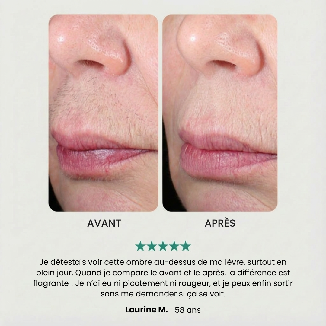 EpilPro - Épilateur visage